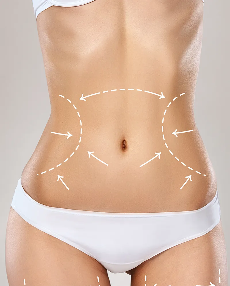 Golden Body Slim 1