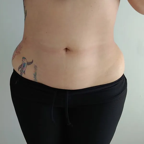 Bariatría Clínica y Nutrición App